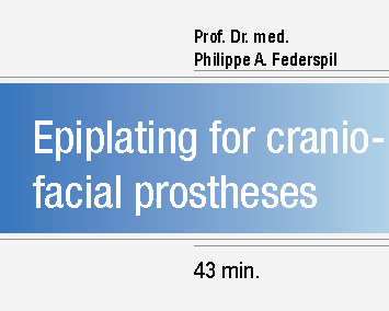 Epiplating for craniofacial prostheses